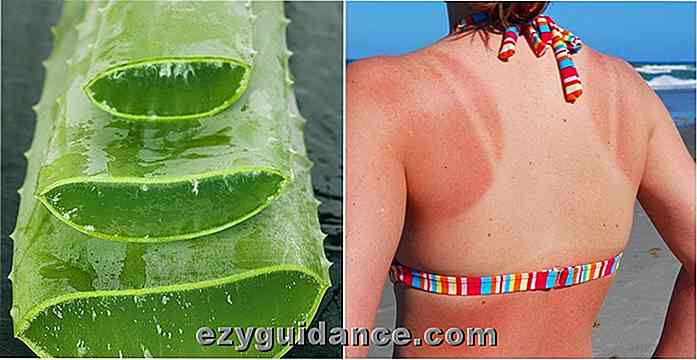 3 sätt att använda Aloe Vera för att läka en solbränna snabbt