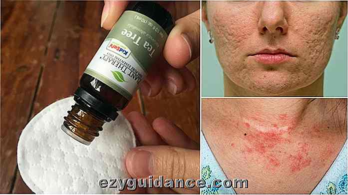 10 skäl att lägga Tea Tree Oil på din hud: Beat Acne, Eczema & More