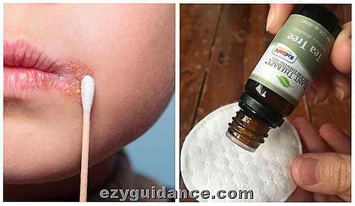 10 bästa essentiella oljor för kalla sår och hur man använder dem