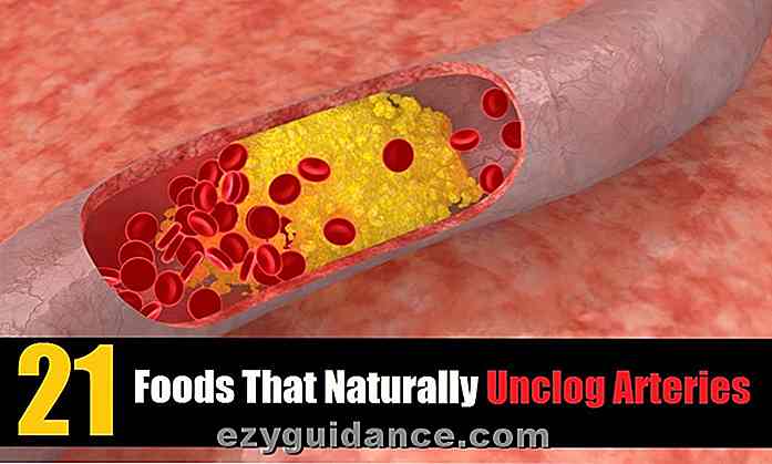 21 livsmedel som naturligt avkorkar arterier
