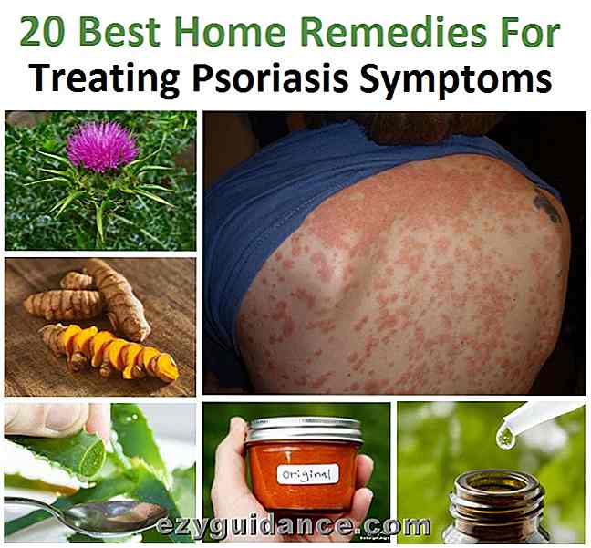 20 bästa hem rättsmedel för behandling av psoriasis symptom