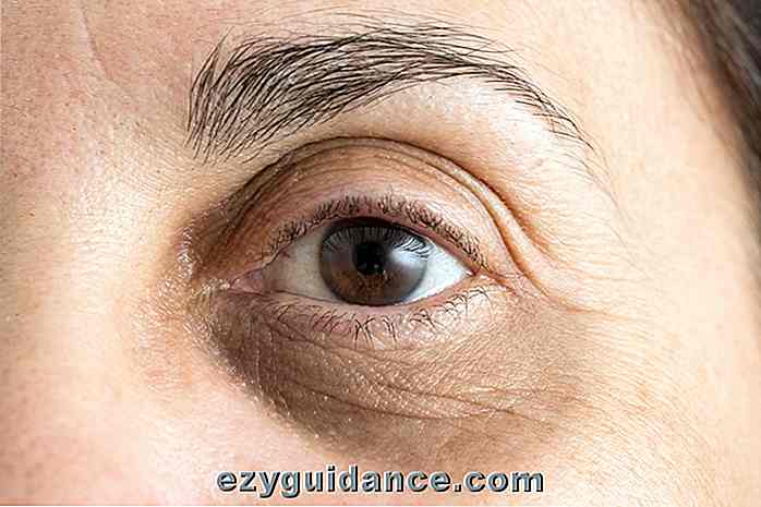 10 formas naturales de deshacerse de círculos oscuros debajo de los ojos