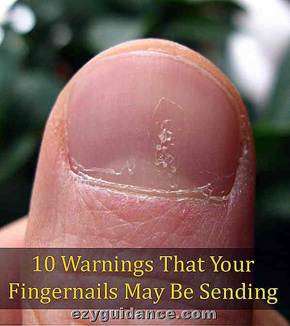 10 varningar som dina fingernaglar kan sända