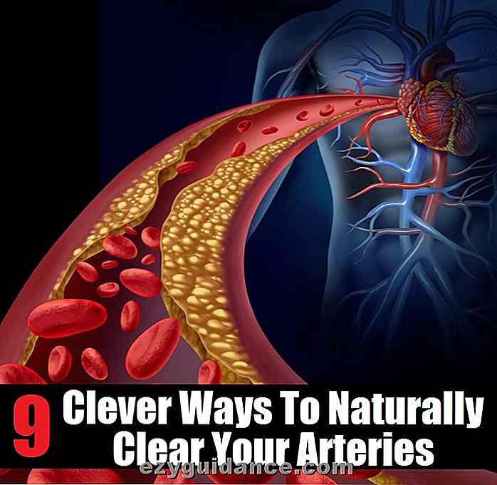 9 maneras inteligentes de eliminar naturalmente las arterias