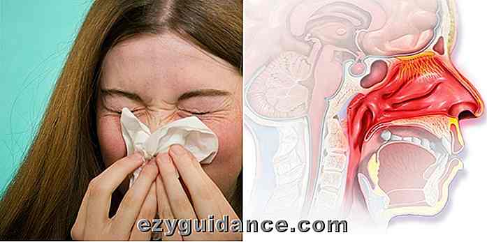 7 Science Backed Home Remedies, um eine verstopfte Nase sofort zu löschen