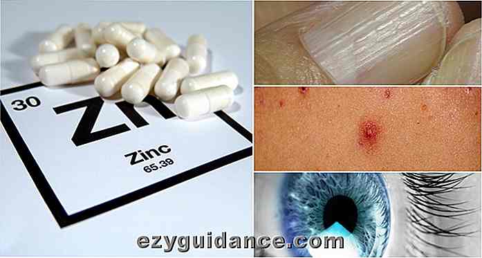 8 señales de advertencia de la deficiencia de zinc y cómo solucionarlo