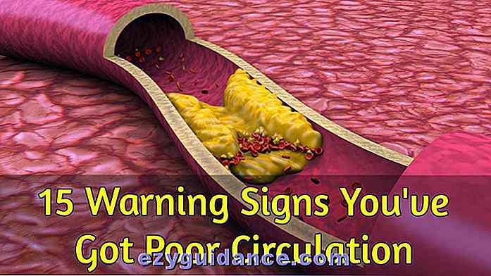 15 Warnzeichen Sie haben schlechte Durchblutung